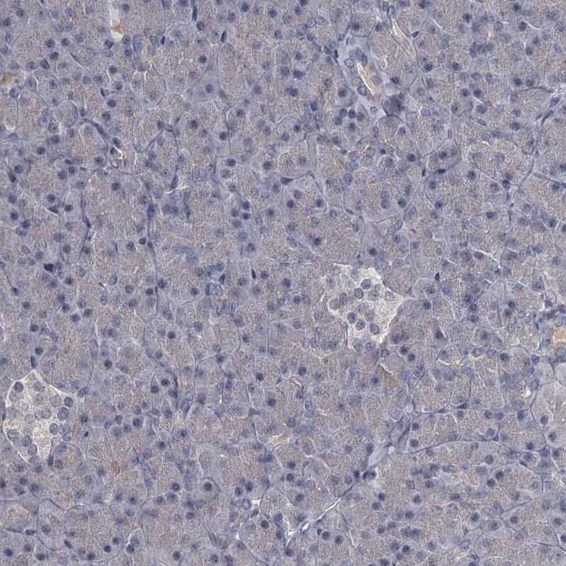 Immunohistochemistry-Paraffin FLVCR2 Antibody - BSA Free
