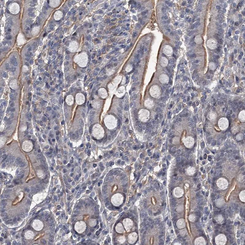Immunohistochemistry-Paraffin FLVCR2 Antibody - BSA Free