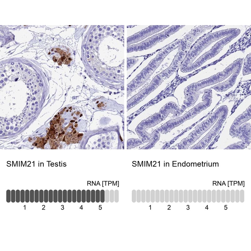 Analysis in human testis and endometrium tissues using Anti-SMIM21 antibody. Corresponding SMIM21 RNA-seq data are presented for the same tissues.