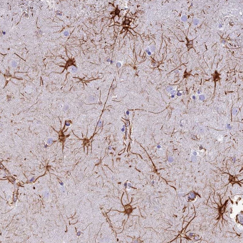 Staining of human caudate shows distinct positivity in astrocytes.