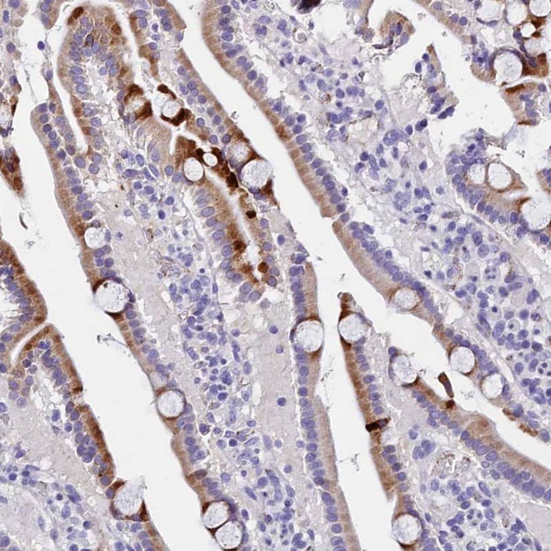Staining of human duodenum shows strong positivity in a subset of glandular cells.