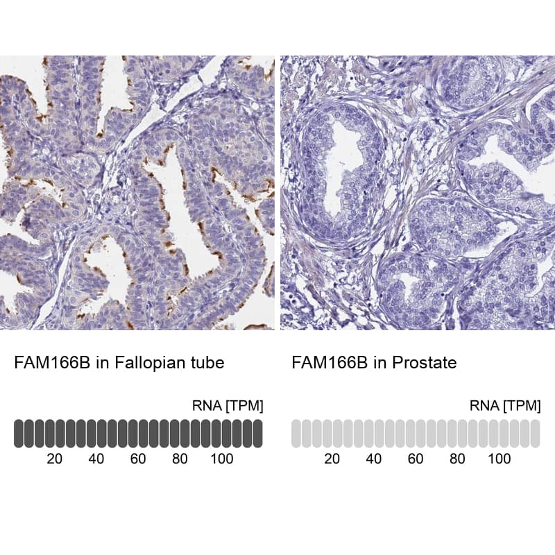 Analysis in human fallopian tube and prostate tissues using Anti-FAM166B antibody. Corresponding FAM166B RNA-seq data are presented for the same tissues.