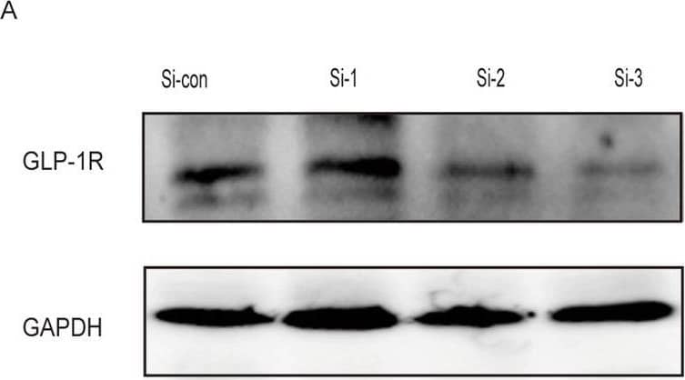 Western Blot: GLP-1R Antibody - BSA Free [NBP1-97308] - Liraglutide reduces apoptosis of hCMSCs via PKA/ beta -catenin pathway. a Western blot & b RT-qPCR verify the knockdown effects of three Si-GLP-1R in hCMSCs. c, d Western blot was used to detect of  beta -catenin & p-beta -catenin expression under the stimulation of LPS by adding 20 μM H89 or 100 nM Si-GLP-1R & liraglutide. e The expression of apoptotic proteins Bax, Bcl-2, cleaved caspase-9, & cleaved caspase-3 was detected by western blot with PKA inhibitor H89 & liraglutide. f The expression of GLP-1R & apoptotic proteins Bax, Bcl-2, cleaved caspase-9, & cleaved caspase-3 were detected by western blot with Si-GLP-1R & liraglutide. Error bars represent mean ± SD from three independent experiments. Compared with Si-con group, ***P < 0.001 Image collected & cropped by CiteAb from the following publication (//pubmed.ncbi.nlm.nih.gov/32429994), licensed under a CC-BY license. Not internally tested by Novus Biologicals.