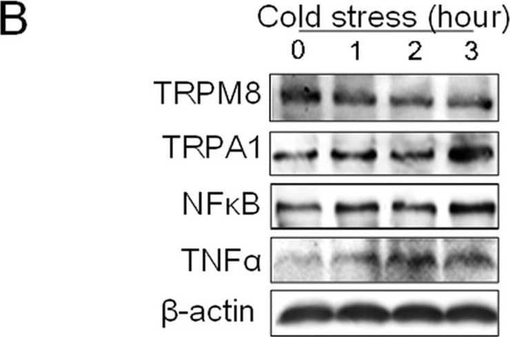 Western Blot: TRPM8 Antibody - BSA Free [NBP1-97311] - Expression of TRPM8, TRPA1, NF kappa B & TNF alpha  in PC12 cells with Trpm8 knockdown under cold conditions (4 °C).(A) Construction of a Trpm8 (Dylight 649) knockdown stable cell line. WT represents wild type cells. KD signifies the Trpm8 knockdown cells. (B,C) Protein expression levels of TRPM8, TRPA1, NF kappa B & TNF alpha . NS: no significance. Data are shown as the mean ± S.D. from three experiments. #P < 0.05; ##P < 0.01, v.s. the control (zero time). Image collected & cropped by CiteAb from the following publication (//www.nature.com/articles/srep45155), licensed under a CC-BY license. Not internally tested by Novus Biologicals.