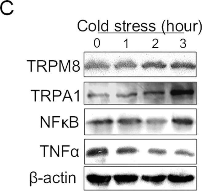 Western Blot: TRPM8 Antibody - BSA Free [NBP1-97311] - Expression of TRPM8, TRPA1, NF kappa B & TNF alpha  in PC12 cells under cold conditions.(A) Intracellular Ca2+ in the cells under cold conditions (4 °C). The Ca2+ concentration in the cytoplasm at 4 °C is higher than that at 37 °C. (B) The mRNA expression levels of TRPM8, TRPA1, NF kappa B & TNF alpha . (C,D) The protein expression levels of TRPM8, TRPA1, NF kappa B & TNF alpha . Data are shown as the mean ± S.D. from three experiments. #P < 0.05; ##P < 0.01, v.s. the control (zero time). Image collected & cropped by CiteAb from the following publication (//www.nature.com/articles/srep45155), licensed under a CC-BY license. Not internally tested by Novus Biologicals.