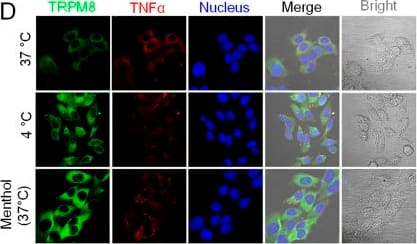 Immunocytochemistry/ Immunofluorescence: TRPM8 Antibody - BSA Free [NBP1-97311] - Confocal imaging of TRPM8, NF kappa B & TNF alpha  expression in PC12 cells.(A) The expression of TRPM8, NF kappa B & TNF alpha  in wild type cells & Trpm8 knockdown cells at 37 °C & 4 °C. KD signifies Trpm8 knockdown cells. (B) In wild type cells, TRPM8 was upregulated & NF kappa B & TNF alpha  were downregulated under cold conditions. (C) In KD cells, TRPM8 showed weak expression & NF kappa B & TNF alpha  expression levels were increased. (D) Co-localization of TRPM8 & TNF alpha  in the cytoplasm (cold condition & 500 nM menthol). Data are shown as the mean ± S.D. from three experiments. *P < 0.05; **P < 0.01. Image collected & cropped by CiteAb from the following publication (//www.nature.com/articles/srep45155), licensed under a CC-BY license. Not internally tested by Novus Biologicals.