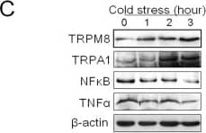 Western Blot: TRPM8 Antibody - BSA Free [NBP1-97311] - Alteration of core temperature & the expression levels of TRPM8, TRPA1, NF kappa B & TNF alpha  in mouse brains under cold conditions.(A) Core body temperature under cold conditions (4 °C). (B) The mRNA expression levels of TRPM8, TRPA1, NF kappa B & TNF alpha . (C,D) The protein expression levels of TRPM8, TRPA1, NF kappa B & TNF alpha . Data are shown as the mean ± S.D. from 12 mice in each group. ##v.s. the control (zero hour), P < 0.01; #P < 0.05. Image collected & cropped by CiteAb from the following publication (//www.nature.com/articles/srep45155), licensed under a CC-BY license. Not internally tested by Novus Biologicals.