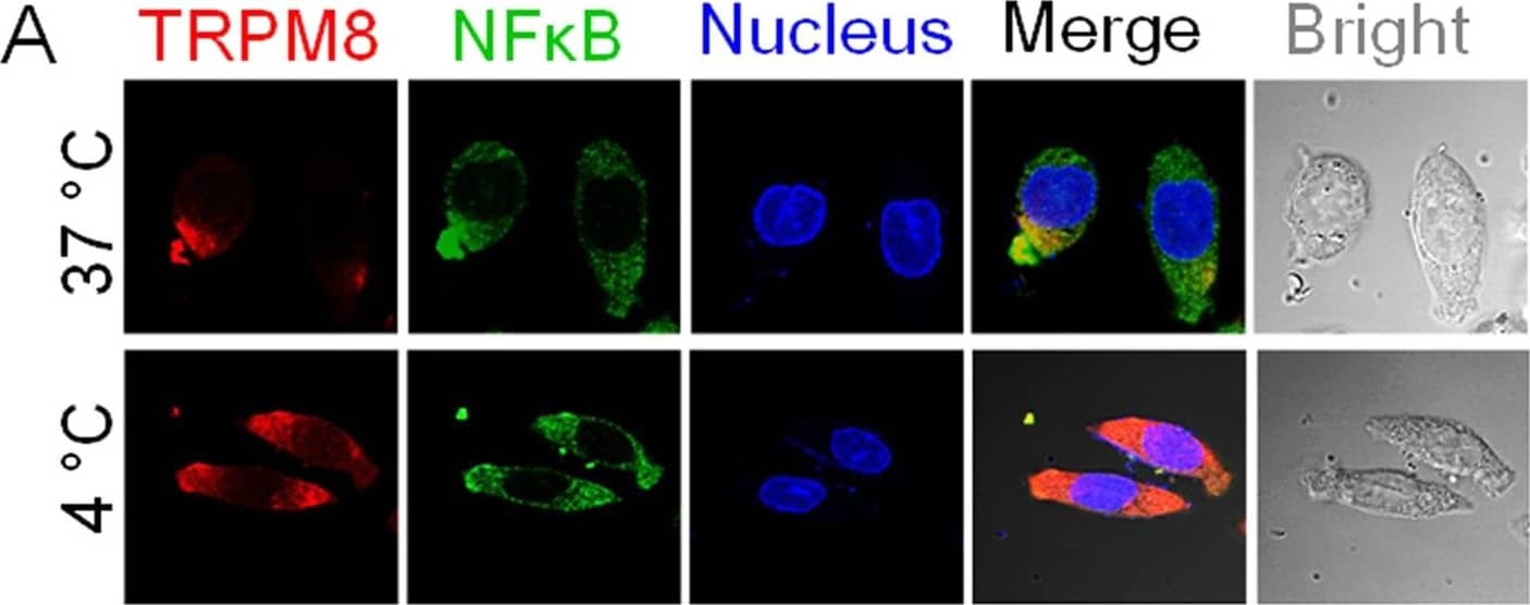 Immunocytochemistry/ Immunofluorescence: TRPM8 Antibody - BSA Free [NBP1-97311] - Co-localization of TRPM8 & NF kappa B in PC12 cells under cold conditions.(A) Immunofluorescence assay image of TRPM8 & NF kappa B in the cytoplasm. WT represents wild type cells. KD represents Trpm8 knockdown cells. (B) The results of co-immunoprecipitation (CoIP) of endogenous TRPM8 & NF kappa B using NF kappa B antibodies. Western blot analysis was carried out to detect TRPM8 & NF kappa B. (C) Reverse CoIP confirmed interaction between NF kappa B & TRPM8. CoIPs were also performed with TRPM8 antibodies. Western blot analysis was carried out by TRPM8 & NF kappa B. Data are shown as the mean ± S.D. from three experiments. *P < 0.05; **P < 0.01. Image collected & cropped by CiteAb from the following publication (//www.nature.com/articles/srep45155), licensed under a CC-BY license. Not internally tested by Novus Biologicals.