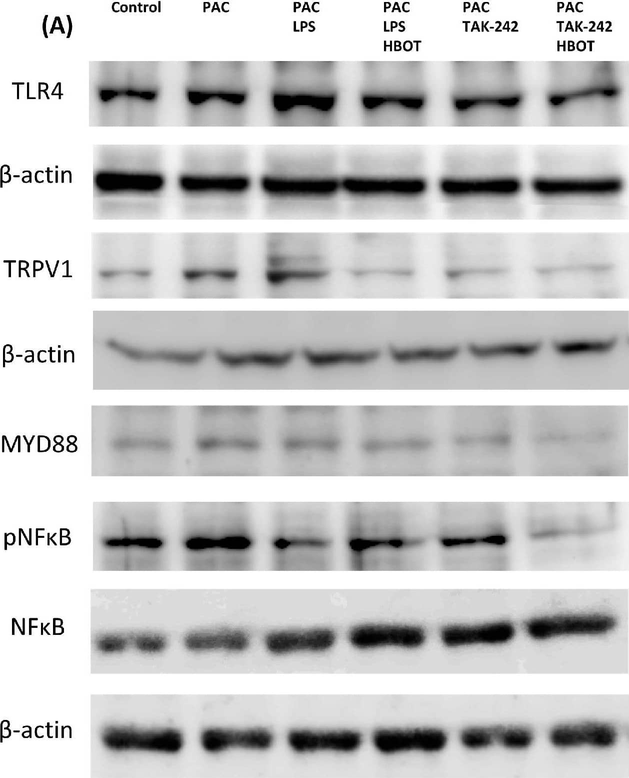 Western Blot Vanilloid R1/TRPV1 Antibody - BSA Free