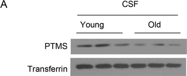 Western Blot: Transferrin Antibody [NBP1-97472] - PTMS secretion declines during aging.(A, B) PTMS levels in the CSF of male C57BL/6 mice at young (∼4 mo) or old (∼24 mo) age were measured by Western blot (A) which were quantified in panel (B). Transferrin was used to as a loading control. (C) Young (3-mo) or middle aged (18-mo) male C57BL/6 mice received unilateral injection of the same dose of Sox2 promoter-driven PTMS-HA lentivirus in the mediobasal hypothalamus. White arrows point to the site of injections. At 1 wk postinjection, hypothalamic sections were generated for HA immunostaining to show the levels of both primary expression of PTMS-HA in Sox2-positive cells & secondary transfer of PTMS-HA into Sox2-negative cells. Sox2 co-immunostaining was performed to reveal Sox2-positive cells in this region. Lower panels in show high-magnification views of outlined areas. Scale bar, 100 μm. 3V: hypothalamic third ventricle. *P < 0.05, two-tailed unpaired t test (B), n = 3 mice per group; values represent the mean ± SEM. Image collected & cropped by CiteAb from the following publication (//pubmed.ncbi.nlm.nih.gov/33087487), licensed under a CC-BY license. Not internally tested by Novus Biologicals.