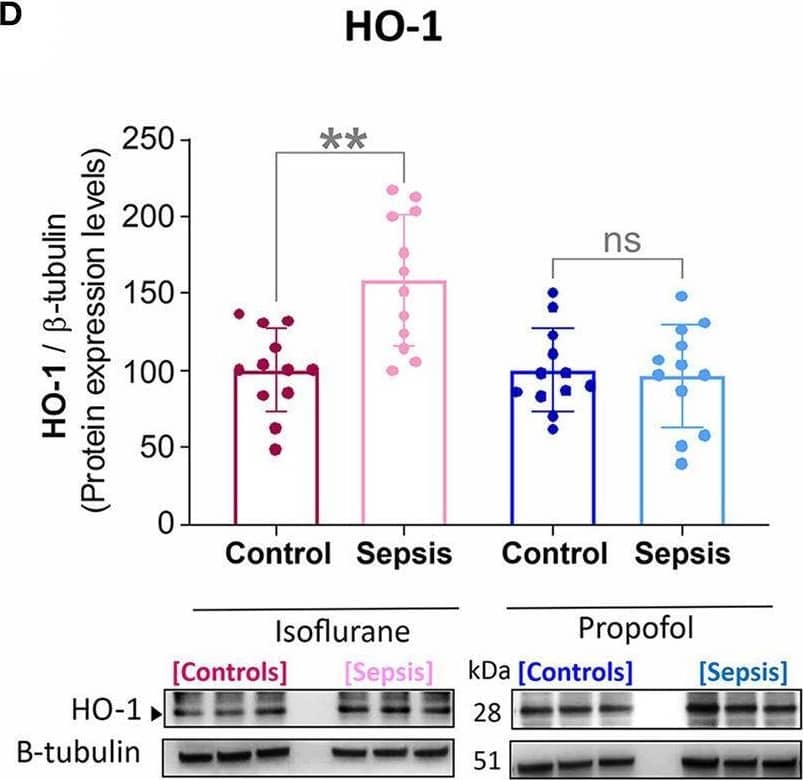Effect of Sepsis with Isoflurane or Propofol anesthesia on Liver HIF1a, Bcl2, iNOS and HO-1, Protein expression levels. (A) HIF-1 alpha  protein was increased in both anesthetic groups by sepsis (Isoflurane +Sepsis, **p = 0.004 and Propofol + Sepsis, *p = 0.04). (B) Bcl-2 protein was increased in Isoflurane +Sepsis group (**p = 0.004) and no significant change in Propofol + Sepsis (*p = 0.104). (C) Inducible nitric oxide synthase [iNOS, (**p = 0.002)] and (D) Heme oxygenase-1 (HO-1, ***p = 0.0006) was increased in Isoflurane +Sepsis group. Whereas, in animals anesthetized with Propofol, three organ-protective proteins, Bcl-2, iNOS, and HO-1 expression was unchanged significantly. Data are shown in mean +/- S.D, n = 12. *denotes a statistically significant (P ⩽ 0.05) difference between animals exposed to sepsis and controls. Statistical differences between results were evaluated using the t-test. “ns