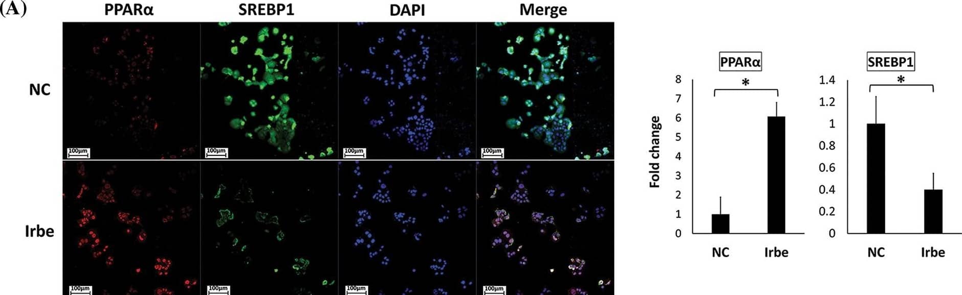 The PPAR alpha  activator, Irbe, reduces SREBP1 expression and induces the expression and co-localization of PPAR alpha  and p21/p27 in Ishikawa cells. (A) Dual immunofluorescent staining for PPAR alpha  (red) and SREBP1 (green) show that the Irbe (100 uM) treatment increased the nuclear expression of the PPAR alpha  protein while decreasing that of SREBP1. (B, C) Dual immunofluorescent staining for PPAR alpha  (red) and p21 (B) or p27 (C) (green) showed that the Irbe treatment increased the expression of both proteins, and their distribution was almost consistent. *p < 0.05. Image collected and cropped by CiteAb from the following open publication (//pubmed.ncbi.nlm.nih.gov/37305395), licensed under a CC-BY license. Not internally tested by Novus Biologicals.