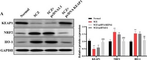 KEAP1 modulates ferroptosis through NRF2/HO‐1 pathway in hiPSC‐derived cINs. (A) Western blot showed the expression of NRF2 and HO‐1. (B) Quantification of Fe2⁺ levels, using an iron content determination assay. (C) Measurement of MDA levels using an MDA assay kit. (D) Quantification of GSH levels using a GSH assay kit. (E) Assessment of GPX4 activity using an ELISA kit. (F) GPX4 mRNA and protein were evaluated by qRT‐PCR and Western blot analysis, respectively. (G) Measurement of lipid oxidation using C11‐BODIPY staining, a dye specific for detecting lipid reactive oxygen species. (H) Quantification of inflammatory cytokines in the cell culture supernatant using ELISA kits. *p < 0.05 and **p < 0.01 show statistical significance when compared to SCZ‐pcDNA KEAP1 group. Image collected and cropped by CiteAb from the following open publication (//pubmed.ncbi.nlm.nih.gov/40021790), licensed under a CC-BY license. Not internally tested by Novus Biologicals.