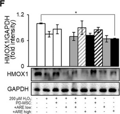 ARE-primed PD-MSCs increased antioxidant and anti-inflammatory effects in ARPE19 cells. (A) Oxidative stress levels evaluated in ARPE19 cells using MitoSOX/MitoTracker staining and (B) intensity quantified by image J. The gray bar, gray hatch bar, black bar, black hatch bar means ARPE19 cells with H2O2 and ARE low, ARPE19 cells with with H2O2, ARE low and PD-MSCs, ARPE19 cells with H2O2 and ARE high and ARPE19 cells with with H2O2, ARE high and PD-MSCs. The mRNA levels of (C) SOD1 and (D) HMOX1 analyzed by qRT-PCR. The protein levels of (E) SOD1 and (F) HMOX1 analyzed by Western blot. The mRNA levels of (G) TGFB1, (H) IL6 analyzed by qRT-PCR. The protein levels of (I) TGFB1 and (J) IL6 analyzed by Western blot. Scale bar = 200 μm. Each experiment was replicated three times, resulting in a total sample size of three (n = 3). The data represent the mean +/- SEM. Statistical significance was determined by using one-way ANOVA and Tukey’s post hoc test for the comparison of groups, * p < 0.05. Image collected and cropped by CiteAb from the following open publication (//pubmed.ncbi.nlm.nih.gov/39056810), licensed under a CC-BY license. Not internally tested by Novus Biologicals.
