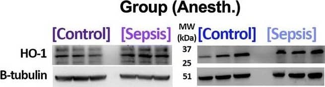 Protein expression data (upper) and representative raw data (lower) for animals anesthetized with isoflurane (bcl-2 [a median + IQR], HIF-1 alpha  [b mean + 95% confidence interval (CI)], HO-1 [c mean + 95% CI for isoflurane, median + IQR for propofol], iNOS [d mean + 95% CI for isoflurane, median + IQR for propofol) *denotes a statistically significant difference between animals exposed to sepsis and controls Image collected and cropped by CiteAb from the following open publication (//pubmed.ncbi.nlm.nih.gov/31307382), licensed under a CC-BY license. Not internally tested by Novus Biologicals.