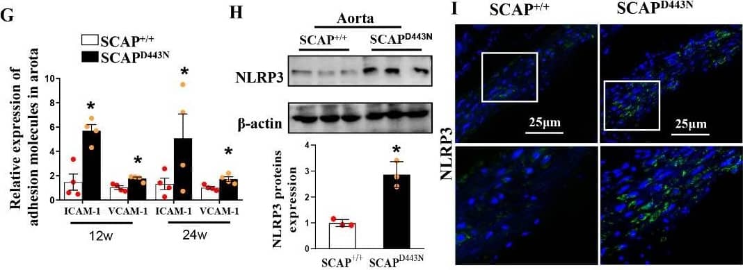 Western Blot: NLRP3/NALP3 Antibody (Nalpy3-b) - BSA Free [NBP1-97601] - Sterol-resistant SCAP overexpression in VSMCs causes inflammation & lipid deposition in the aortas of SCAPD443N mice. (A & B) Representative images of an aortic root stained with Oil Red O in SCAPD443N mice & SCAP+/+ mice after 12 or 24 weeks of Western diet feeding. (C) Quantification of plaque areas in SCAPD443N mice & SCAP+/+ mice after 12 or 24 weeks of Western diet feeding (n=5). (D) Plasma levels of TC, TG, LDL-C & HDL-C in SCAPD443N mice & SCAP+/+ mice after 12 or 24 weeks of Western diet feeding (n=5). (E) mRNA expression of proin?ammatory cytokines (IL-1 beta , IL-6, IL-18, & TNF-alpha ) as measured by qRT-PCR (n=4). (F) mRNA expression of pro-chemokine cytokines (MCP-1, MIP-1 alpha , MIP-1 beta , & CX3CL1) as measured by qRT-PCR (n=4). (G) mRNA expression of ICAM-1 & VCAM-1 in aortas as measured by qRT-PCR (n=4). (H) Representative immunoblots for NLRP3 proteins in SCAP+/+ mice & SCAPD443N mice (n=3). (I) Representative images of immuno?uorescence staining of NLRP3 proteins in the aortas of SCAPD443N mice & SCAP+/+ mice (n=5). The data are presented as the means±SD of 3-5 independent experiments. *P<0.05, vs. the SCAP+/+ group. Statistical significance was calculated for the biological replicates by 2-tailed Student’s t test. Image collected & cropped by CiteAb from the following publication (//pubmed.ncbi.nlm.nih.gov/34094640), licensed under a CC-BY license. Not internally tested by Novus Biologicals.