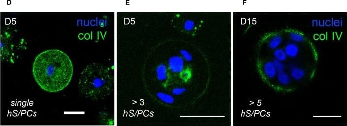 hS/PCs sequentially secrete basement membrane proteins during microstructure reorganization and function. Encapsulated hS/PCs in HA-PEGDA hydrogels initially produce laminin (red) (A–C) and collagen IV (green) (D–F) even at the single-cell state (A,D). Perlecan (green) (G–I) secretion follows to stabilize the laminin and collagen IV networks. Scalebar = 20 μm in all confocal micrographs. Image collected and cropped by CiteAb from the following open publication (//pubmed.ncbi.nlm.nih.gov/31750298), licensed under a CC-BY license. Not internally tested by Novus Biologicals.