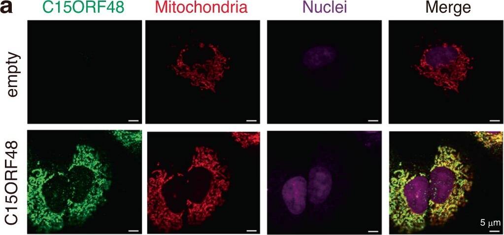 C15ORF48 expression activates AMPK-ULK1 signaling.a A549 cells stably expressing C15ORF48 (A549/C15ORF48) or the empty (A549/empty) vector were fixed and stained with anti-C15ORF48 antibody and MitoTracker. Nuclei were counter-stained with TO-PRO-3. Representative images are shown from three independent experiments. b A549/empty and A549/C15ORF48 cells were analyzed for mitochondrial membrane potential by staining with TMRM (30 nM) for 30 min. Median TMRM fluorescence intensities are shown as the mean +/- SD. Statistical significance was calculated using two-tailed unpaired Student’s t test (n = 3, biological replicates). c A549/empty and A549/C15ORF48 cells were analyzed for intracellular ATP levels. ATP amount in a cell is shown as the mean +/- SD. Statistical significance was calculated using two-tailed unpaired Student’s t test (n = 3, biological replicates). d A549/empty and A549/C15ORF48 cells were lysed and subjected to western blotting with indicated antibodies. Band intensity was measured, and quantitative ratios are shown. Data are representative of three independent experiments with three biological replicates. Image collected and cropped by CiteAb from the following open publication (//www.nature.com/articles/s41467-024-45206-1), licensed under a CC-BY license. Not internally tested by Novus Biologicals.