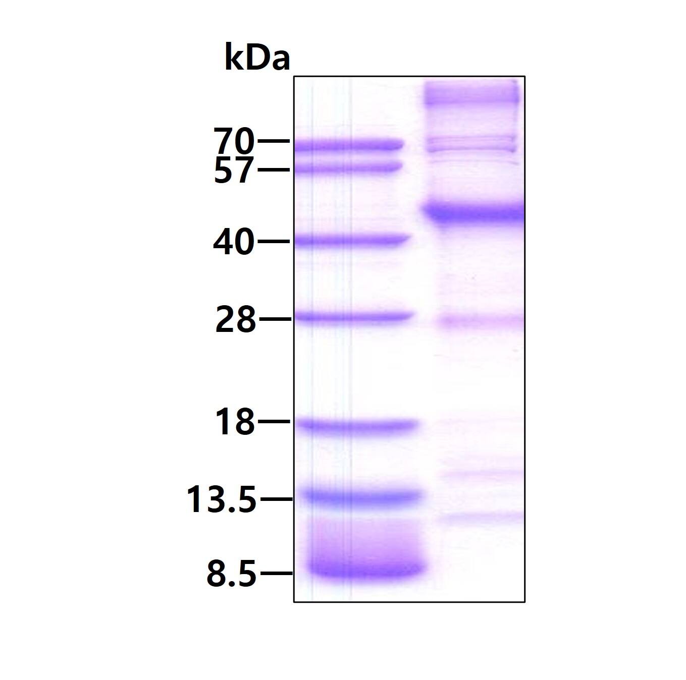 SDS-Page: Recombinant Human MAGEA6 Protein [NBP1-98966] - 3ug by SDS-PAGE under reducing condition and visualized by Coomassie blue stain.
