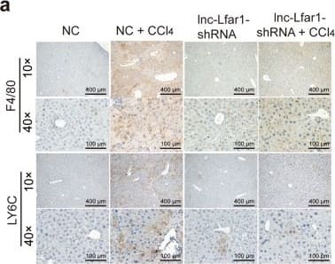 Immunohistochemistry: Ly-6G/Ly-6C Antibody (RB6-8C5) - BSA Free [NBP2-00441] - Silencing lnc-Lfar1 alleviates CCl4-induced proinflammatory activation of macrophages.Mice were treated with oil in combination with injection of lenti-NC (NC, n = 10), CCl4 in combination with injection of lenti-NC (NC + CCl4, n = 10), oil in combination with injection of lenti-lnc-Lfar1-shRNA (lnc-Lfar1-shRNA, n = 10), & CCl4 in combination with injection of lenti-lnc-Lfar1-shRNA (lnc-Lfar1-shRNA + CCl4, n = 10). a Immunohistochemistry analysis was performed to detect the expression of F4/80 & LY6C; scale bar = 400 μm for 10 × and 100 μm for 40×. b The protein level of F4/80, CD11b & LY6C was determined by western blot. GAPDH was used as an internal control. c The mRNA level of F4/80, Ly6c, Ccr2, Cd20, Il-6, iNos, Ccl5, Cxcl5, Cxcl9 & Cxcl10 was determined by qRT-PCR. *p < 0.05 vs NC, #p < 0.05 vs NC + CCl4. Image collected & cropped by CiteAb from the following publication (//pubmed.ncbi.nlm.nih.gov/32071306), licensed under a CC-BY license. Not internally tested by Novus Biologicals.