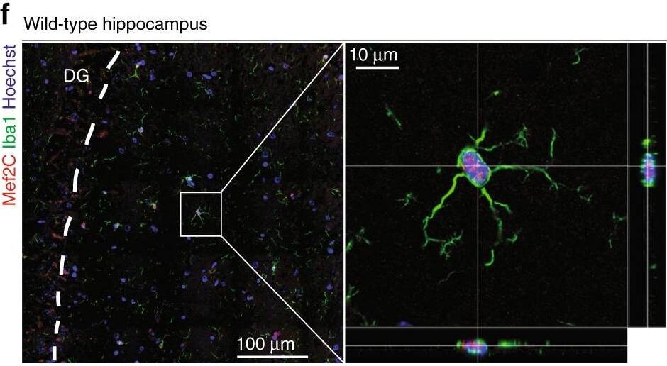 Microglial expression of Mef2C is reduced upon IFN-I overexpression and ageing. a, b mRNA expression levels of Mef2C (number of reads) in microglia of young and aged (a) and young AAV-IFN beta - and AAV-CTRL-infected mice (b). **P < 0.01, *P < 0,05; unpaired t-test, n = 5 per group. c Correlation between expression levels of Mef2C and IFN-I-dependent Ifit1 in microglia of non-manipulated young and aged mice, young mice infected with AAV-IFN beta  or AAV-CTRL and aged mice injected with anti-IFNAR antibody (data combined from Supplementary Datasets 1-3; Pearson R2 = 0.378, P < 0.0001, n = 34). d, e Correlation analysis between expression levels of IFN-I-dependent Irf7 and Isg15, and Mef2C reveals negative relationship in mic-IFNAR-CTRL microglia (n = 8) (d) but not in micIFNAR-KO microglia (n = 13) (e) suggesting direct effect of IFN-I on microglial expression levels of Mef2C. f Confocal images of nuclear (Hoechst nuclear staining in blue) Mef2C (red) expression in Iba1+ microglia (green) from adult wild-type mouse using orthogonal projections of confocal z-stacks. g, h Representative pictures of Mef2C staining (red), Iba1+ (green) microglia and Hoechst nuclear staining (blue) in hippocampal sections of non-manipulated young and aged mice (g) and young mice infected with AAV-IFN beta  or AAV-CTRL (h) Image collected and cropped by CiteAb from the following open publication (//pubmed.ncbi.nlm.nih.gov/28959042), licensed under a CC-BY license. Not internally tested by Novus Biologicals.