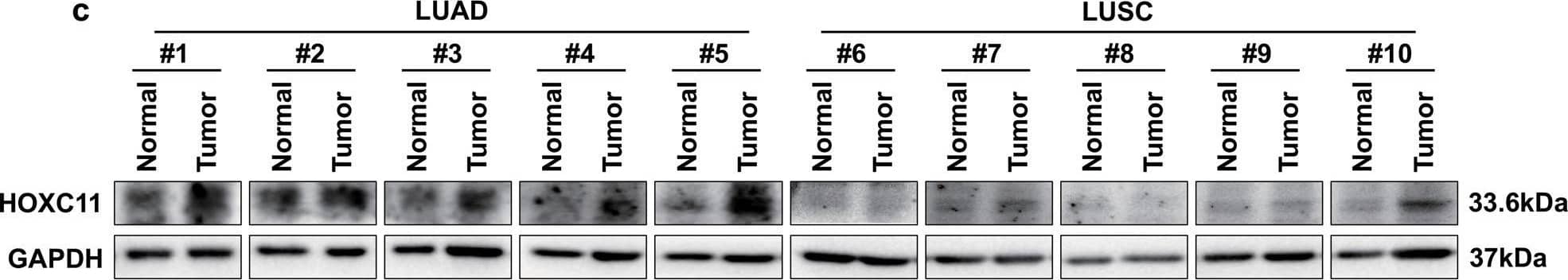 HOXC11 is highly expressed in lung adenocarcinoma and correlates with poor overall survival of LUAD.a A heatmap of mRNA level of HOX family genes in LUAD/LUSC and paracancerous samples. b mRNA level of HOXC11 in LUAD/LUSC and paracancerous samples. Data in (a) and (b) are obtained from the TCGA database. c HOXC11 protein expression in LUAD/LUSC and paracancerous tissues. d The relationship between HOXC11 expression and overall survival of lung cancer patients. e The relationship between HOXC11 expression and overall survival of LUAD patients. f The relationship between HOXC11 expression and gender of lung cancer patients. g The relationship between HOXC11 expression and smoking habits of lung cancer patients. Data from (d) to (g) come from the Kaplan–Meier Plotter lung cancer dataset. ***P < 0.001, ****P < 0.0001. Image collected and cropped by CiteAb from the following open publication (//pubmed.ncbi.nlm.nih.gov/36823149), licensed under a CC-BY license. Not internally tested by Novus Biologicals.