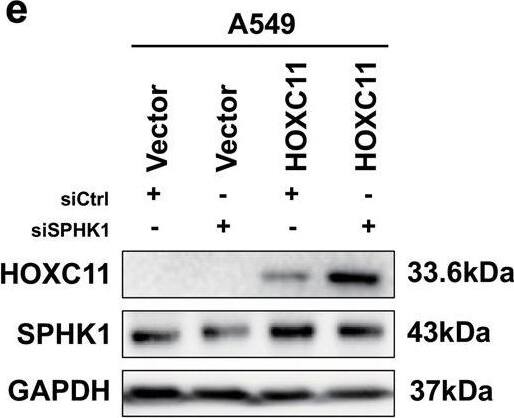 SPHK1 accelerates the progression of lung cancer.a Cell proliferation ability of SPHK1 stable overexpressed cells detected by cell counting kit-8. Data are shown as mean +/- SD (n = 5). b Colony formation assays showing the colony formatted ability of SPHK1 stable overexpressed cells and the quantitative analyses. Data are shown as mean +/- SD (n = 3). c Cell migration and invasion ability of SPHK1 stable overexpressed cells detected by Transwell assays and the quantitative analyses. Data are shown as mean +/- SD (n = 3). d Flow cytometry detecting the cell cycle of SPHK1 overexpressed cells. Differences are compared with the sgCtrl group; data are shown as mean +/- SD (n = 3). e Western blot detected the SPHK1 protein level of HOXC11 overexpressing cells with the treatment of SPHK1 interference. f Cell counting kit-8 detected the cell viability of HOXC11 overexpressing cell line with the treatment of SPHK1 interference. Data are shown as mean +/- SD (n = 5). g Transwell assays detected the migration and invasion ability of HOXC11 overexpressing cell line with the treatment of SPHK1 interference and the quantitative analyses. Differences were compared to the Vector group transfected with Ctrl siRNA. Data are shown as mean +/- SD (n = 3). NS not significant, *P < 0.05, **P < 0.01, *** P < 0.001, ****P < 0.0001. Image collected and cropped by CiteAb from the following open publication (//pubmed.ncbi.nlm.nih.gov/36823149), licensed under a CC-BY license. Not internally tested by Novus Biologicals.