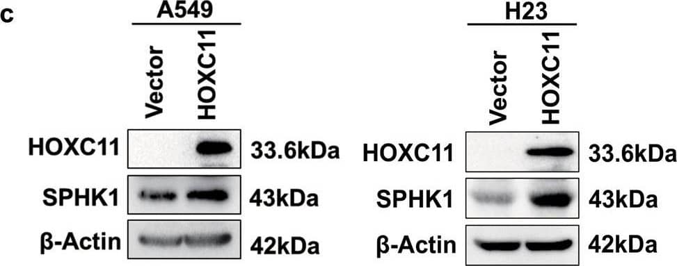 HOXC11 binds to the promoter of SPHK1 to facilitate its expression, predicting a worse prognosis.a GSEA analyzed potential binding targets of HOXC11. b qPCR analysis of CCL5, HBA2, and SPHK1 expression level after stable overexpression of HOXC11. Data are shown as mean +/- SD (n = 3). c Western Blot analysis of SPHK1 protein expression level after HOXC11 stable overexpression. d Western Blot analysis of SPHK1 protein expression level after HOXC11 knockout. e Relative enrichment of SPHK1 promoter in HOXC11 stable overexpressing cells. Data are shown as mean +/- SD (n = 3). f Western Blot detected SPHK1 protein expression of HOXC11 knockout cells and that after transiently transfected with 1.5 μg HOXC11 expression plasmid. NS not significant, *P < 0.05, **P < 0.01. Image collected and cropped by CiteAb from the following open publication (//pubmed.ncbi.nlm.nih.gov/36823149), licensed under a CC-BY license. Not internally tested by Novus Biologicals.