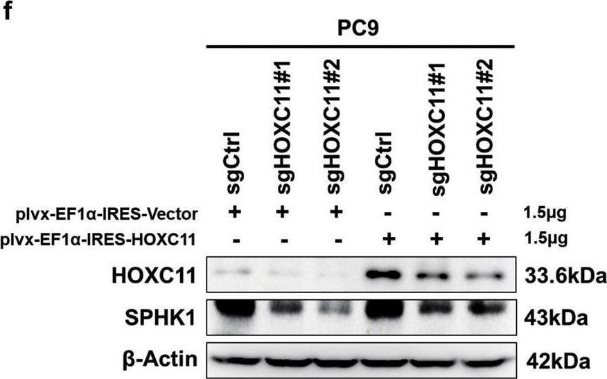 HOXC11 binds to the promoter of SPHK1 to facilitate its expression, predicting a worse prognosis.a GSEA analyzed potential binding targets of HOXC11. b qPCR analysis of CCL5, HBA2, and SPHK1 expression level after stable overexpression of HOXC11. Data are shown as mean +/- SD (n = 3). c Western Blot analysis of SPHK1 protein expression level after HOXC11 stable overexpression. d Western Blot analysis of SPHK1 protein expression level after HOXC11 knockout. e Relative enrichment of SPHK1 promoter in HOXC11 stable overexpressing cells. Data are shown as mean +/- SD (n = 3). f Western Blot detected SPHK1 protein expression of HOXC11 knockout cells and that after transiently transfected with 1.5 μg HOXC11 expression plasmid. NS not significant, *P < 0.05, **P < 0.01. Image collected and cropped by CiteAb from the following open publication (//pubmed.ncbi.nlm.nih.gov/36823149), licensed under a CC-BY license. Not internally tested by Novus Biologicals.
