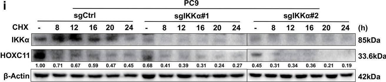 IKK alpha  regulates HOXC11 expression at the post-transcriptional level.a Western Blot showed the up-regulation of HOXC11 resulting from IKK alpha  stable overexpression. b Western Blot detected the down-regulation of HOXC11 resulting from the IKK alpha  knockout. c qPCR analysis of HOXC11 mRNA level after stable overexpression of IKK alpha . Data are shown as mean +/- SD (n = 3). d Western Blot showing HOXC11 protein cumulation after treatment with MG132 (10 μM, 24 h). e Western Blot showed HOXC11 protein degradation after treatment with cycloheximide (10 μg/ml). f Western Blot analysis of HOXC11 accumulation after IKK alpha  stable overexpression and MG132 treatment (20 μM, 12 h). g Western Blot showed HOXC11 protein expression after IKK alpha  stable overexpression and treatment with cycloheximide (20 μg/ml). h Western Blot analysis of HOXC11 accumulation after IKK alpha  knockout and MG132 treatment (20 μM, 10 h). i Western Blot showed HOXC11 protein expression after IKK alpha  knockout and treatment with cycloheximide (20 μg/ml). j Ubiquitinating and deubiquitinating enzymes of HOXC11 and IKK alpha  predicted by UbiBrowser 2.0. USP8 is shared by HOXC11 and IKK alpha . k USP8 with tag-Myc was instantaneously expressed in HEK293T, and Western Blot detected the protein level of IKK alpha  and HOXC11. l Immunofluorescence detected the localization of IKK alpha  (red) relative to HOXC11 (green) or Myc-USP8 (green) in PC9 cells. Scale bars, 20 μm. Image collected and cropped by CiteAb from the following open publication (//pubmed.ncbi.nlm.nih.gov/36823149), licensed under a CC-BY license. Not internally tested by Novus Biologicals.
