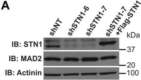 CST deficiency results in SCC loss.A, Western blot of STN1 knockdown and MAD2 levels in HeLa cells. Actinin was used as the loading control. B, example images of metaphase spreads with normal chromosomes or SCC loss. The scale bar represents 5 μm. C, fold increase in cohesion loss after metaphase spread analysis. n = 3 independent, biological replicates. D, representative images of chromosome FISH from cells isolated by mitotic shake-off. Red represents centromere 6 probe; blue represents DAPI. The scale bar represents 5 μm. E, fold increase in nuclei with >4 chromosome 6 foci. n = 4 independent, biological replicates. F, knockdown of CTC1, STN1, or TEN1 by siRNA in HeLa cells. siNT was used as the nontarget control and actinin as the loading control. G, graph of SCC loss after metaphase spread analysis, as indicated. n = 3 independent, biological replicates. (∗p < 0.05, ∗∗p < 0.01, and ∗∗∗p < 0.001). CST, CTC1-STN1-TEN1; SCC, sister chromatid cohesion; shNT, nontargeting shRNA; shSTN1, shRNA knockdown of STN1; shSTN1+Flag-STN1, shSTN1-7 cells plus shRNA-resistant Flag-STN1. Image collected and cropped by CiteAb from the following open publication (//pubmed.ncbi.nlm.nih.gov/34339741), licensed under a CC-BY license. Not internally tested by Novus Biologicals.