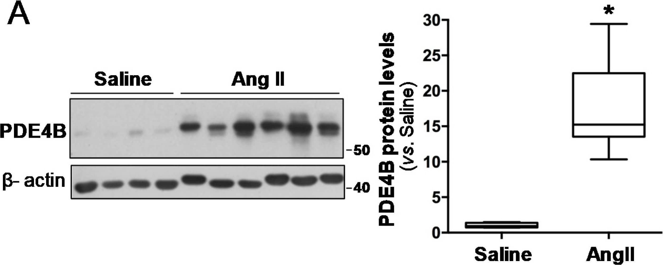 PDE4B expression is up-regulated in the abdominal aortas from AngII-infused ApoE−/− mice. ApoE−/− mice were infused with AngII (1000 ng/kg/min) or saline solution for 28 days. (A) The PDE4B expression in abdominal aortas from these animals was assessed by Western blot. The levels of  beta -actin are shown as a loading control. The boxplot on the right shows the quantification of the PDE4B protein levels. The box extends from the 25th to the 75th percentile, and the median is indicated by a horizontal line. The whiskers represent the maximum and minimum values (Saline, n = 4; Ang II n = 6); * p < 0.01 vs. saline. (B) Representative PDE4B immunostaining in these samples. The arrowheads indicate the PD4B-positive cells in aneurysmal tissues. Bars: 20 um. Image collected and cropped by CiteAb from the following open publication (//pubmed.ncbi.nlm.nih.gov/33809405), licensed under a CC-BY license. Not internally tested by Novus Biologicals.