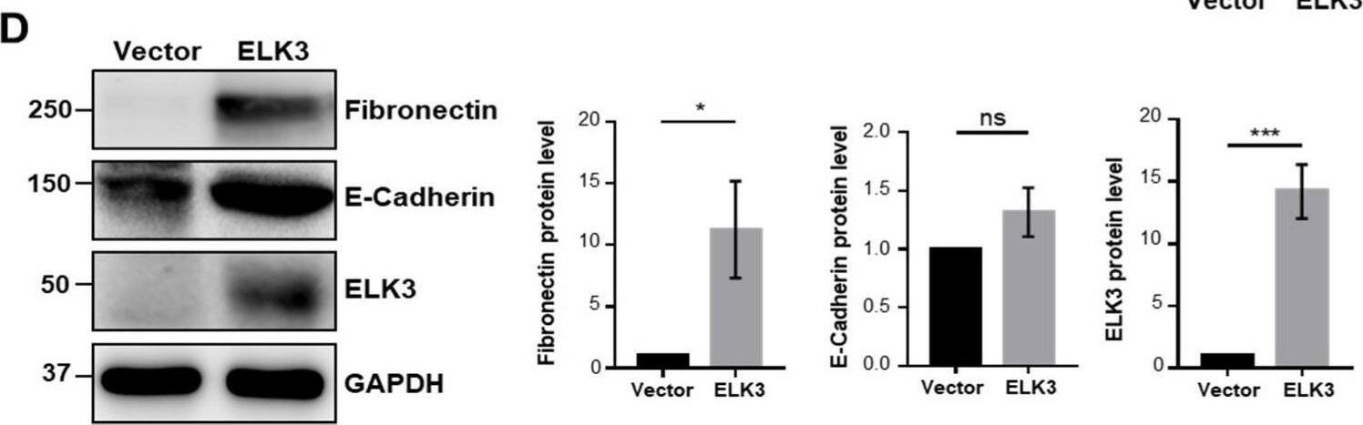 ELK3 increases the migration and invasion of SNU484 cell line in E-cadherin independent manner. (A) ELK3 mRNA levels in SNU484 cells transfected with control vector and pLenti-cMyc-DDK-ELK3 plasmid. Error bars represent the standard deviation; **** p < 0.0001 (student’s t-test). (B) ELK3 protein levels in SNU484 cells transfected with control vector and pLenti-cMyc-DDK-ELK3 plasmid. The values indicate the signal intensities of ELK3 relative to GAPDH. (C) Representative images showing cell migration (top two panels) and cell invasion (bottom two panels) of SNU484 cells transfected with control vector and pLenti-cMyc-DDK-ELK3 plasmid. Scale bar, 200 μm. Bar graphs indicate the number of migrated cells and invaded cells. Error bars represent the standard deviation; ** p < 0.01 and *** p < 0.001 (student’s t-test). (D) Epithelial marker (E-cadherin), mesenchymal marker (Fibronectin), and ELK3 protein expression in SNU484 cells transfected with control vector and ELK3. Bar graphs indicate the quantified levels of each protein, in relative scales. Error bars represent the standard deviation; * p < 0.05 and *** p < 0.001 (student’s t-test). ELK3, ETS transcription factor ELK3; Vector, control vector. Image collected and cropped by CiteAb from the following open publication (//pubmed.ncbi.nlm.nih.gov/35409069), licensed under a CC-BY license. Not internally tested by Novus Biologicals.