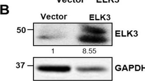 ELK3 increases the migration and invasion of SNU484 cell line in E-cadherin independent manner. (A) ELK3 mRNA levels in SNU484 cells transfected with control vector and pLenti-cMyc-DDK-ELK3 plasmid. Error bars represent the standard deviation; **** p < 0.0001 (student’s t-test). (B) ELK3 protein levels in SNU484 cells transfected with control vector and pLenti-cMyc-DDK-ELK3 plasmid. The values indicate the signal intensities of ELK3 relative to GAPDH. (C) Representative images showing cell migration (top two panels) and cell invasion (bottom two panels) of SNU484 cells transfected with control vector and pLenti-cMyc-DDK-ELK3 plasmid. Scale bar, 200 μm. Bar graphs indicate the number of migrated cells and invaded cells. Error bars represent the standard deviation; ** p < 0.01 and *** p < 0.001 (student’s t-test). (D) Epithelial marker (E-cadherin), mesenchymal marker (Fibronectin), and ELK3 protein expression in SNU484 cells transfected with control vector and ELK3. Bar graphs indicate the quantified levels of each protein, in relative scales. Error bars represent the standard deviation; * p < 0.05 and *** p < 0.001 (student’s t-test). ELK3, ETS transcription factor ELK3; Vector, control vector. Image collected and cropped by CiteAb from the following open publication (//pubmed.ncbi.nlm.nih.gov/35409069), licensed under a CC-BY license. Not internally tested by Novus Biologicals.