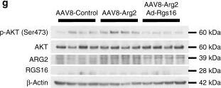 Western Blot: RGS16 Antibody (OTI4E5) [NBP2-01584] - Hepatic RGS16 reconstitution reverses Arg2-mediated improvements in peripheral fat accumulation & glucose homeostasis. a Experimental schematic used to test the role of AAV8-mediated mouse Arg2 & Ad-RGS16 overexpression in db/db mice. b Body weight & c body composition of AAV8-Control or AAV8-Arg2 db/db mice expressing Ad-Control or Ad-RGS16 (n = 8 per group). d VO2, VCO2, energy expenditure, & RER during light & dark cycles in AAV8-Control or AAV8-Arg2 db/db mice expressing Ad-Control or Ad-RGS16 (n = 8 per group). e Serum insulin (left), glucose (middle), & HOMA2 IR (right) in AAV8-Control or AAV8-Arg2 db/db mice expressing Ad-Control or Ad-RGS16 (n = 8 per group). f Intraperitoneal GTT & ITT (n = 5 mice per group). g Western blot analysis of total & phosphorylated AKT in liver samples from db/db AAV8-Control & AAV8-Arg2 mice (n = 4 mice per group). For box plots, the midline represents the median, boxes represent the interquartile range & whiskers show the full range of values. For bar graphs, data represent mean+s.e.m. *P < 0.05, **P < 0.01, ***P < 0.005, ****P < 0.0001; n.s., not significant; relative to control treatment, by two-tailed Student’s t-test Image collected & cropped by CiteAb from the following publication (//pubmed.ncbi.nlm.nih.gov/30962478), licensed under a CC-BY license. Not internally tested by Novus Biologicals.