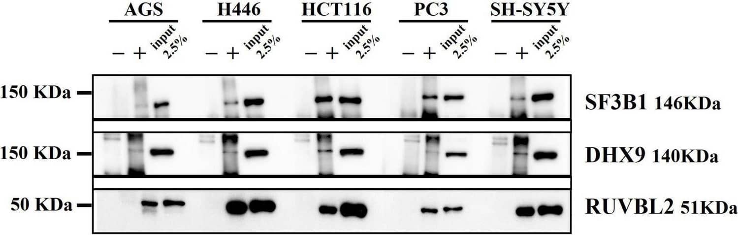 Western blot from DnaK immunoprecipitation comparing the five cancer cell lines. On the left side the Molecular Weight (MW) Marker is indicated. On the right side the name and MW of each validated protein are given. For each of the five cell types, three samples were loaded: the immunoprecipitated DnaK-transfected lysate with the antibody isotype control, the immunoprecipitated DnaK-transfected lysate with anti-V5 antibody and 2.5% load of the Dank-transfected lysate used for the immunoprecipitations. Image collected and cropped by CiteAb from the following open publication (//pubmed.ncbi.nlm.nih.gov/36386669), licensed under a CC-BY license. Not internally tested by Novus Biologicals.