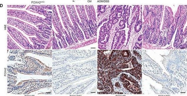 Immunohistochemistry HNF-3 beta/FoxA2 Antibody (OTI3C10)