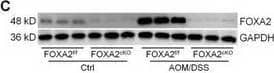 Western Blot HNF-3 beta/FoxA2 Antibody (OTI3C10)