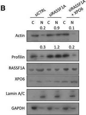 Immunoprecipitation: Profilin 1 Antibody (OTI1D5) [NBP2-02577] - RASSF1A depletion does not affect nuclear F‐actin levelsWestern blot analysis of actin & profilin levels in nuclear & cytoplasmic fractions of cells transfected with truncated RASSF1A mutants.Western blot analysis of actin & profilin levels in nuclear & cytoplasmic fractions of cells transfected with siRASSF1A & siRASSF1A together with XPO6 plasmid.Western blot analysis of actin & profilin levels in nuclear & cytoplasmic fractions of cells transfected with siRNA‐resistant FLAG‐RASSF1A plasmid.Western blot analysis of actin & profilin levels in nuclear & cytoplasmic fractions of cells transfected with siMST2. Quantification of nuclear actin & profilin relative to Lamin A/C is shown. Error bars derive from three independent experiments & represent the SEM.Western blot analysis of exportin‐6 (XPO6) & importin‐9 (IPO9) in the absence of RASSF1A. GAPDH was used as a loading control.Confocal images of endogenous filamentous actin (F‐actin) in siCTRL & siRASSF1A cells using phalloidin staining (Alexa Fluor 568‐conjugated, red). DNA was stained with DAPI. Scale bars = 10 μm.Western blot analysis of actin, profilin, GAPDH & Lamin A/C levels in nuclear & cytoplasmic fractions of MDA‐MB‐231 cells treated with DMSO or 5′‐aza‐dC. The graph shows the nuclear levels of actin & profilin relative to Lamin A/C in MDA‐MB‐231 cells expressing RASSF1A. Error bars derive from two independent experiments & represent the SEM.Data information: Two‐tailed Student's t‐test was used for statistical analysis.*P < 0.05, **P < 0.01, ***P < 0.001.Source data are available online for this figure. Image collected & cropped by CiteAb from the following publication (//pubmed.ncbi.nlm.nih.gov/31414556), licensed under a CC-BY license. Not internally tested by Novus Biologicals.