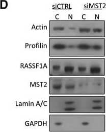 Immunoprecipitation: Profilin 1 Antibody (OTI1D5) [NBP2-02577] - RASSF1A depletion does not affect nuclear F‐actin levelsWestern blot analysis of actin & profilin levels in nuclear & cytoplasmic fractions of cells transfected with truncated RASSF1A mutants.Western blot analysis of actin & profilin levels in nuclear & cytoplasmic fractions of cells transfected with siRASSF1A & siRASSF1A together with XPO6 plasmid.Western blot analysis of actin & profilin levels in nuclear & cytoplasmic fractions of cells transfected with siRNA‐resistant FLAG‐RASSF1A plasmid.Western blot analysis of actin & profilin levels in nuclear & cytoplasmic fractions of cells transfected with siMST2. Quantification of nuclear actin & profilin relative to Lamin A/C is shown. Error bars derive from three independent experiments & represent the SEM.Western blot analysis of exportin‐6 (XPO6) & importin‐9 (IPO9) in the absence of RASSF1A. GAPDH was used as a loading control.Confocal images of endogenous filamentous actin (F‐actin) in siCTRL & siRASSF1A cells using phalloidin staining (Alexa Fluor 568‐conjugated, red). DNA was stained with DAPI. Scale bars = 10 μm.Western blot analysis of actin, profilin, GAPDH & Lamin A/C levels in nuclear & cytoplasmic fractions of MDA‐MB‐231 cells treated with DMSO or 5′‐aza‐dC. The graph shows the nuclear levels of actin & profilin relative to Lamin A/C in MDA‐MB‐231 cells expressing RASSF1A. Error bars derive from two independent experiments & represent the SEM.Data information: Two‐tailed Student's t‐test was used for statistical analysis.*P < 0.05, **P < 0.01, ***P < 0.001.Source data are available online for this figure. Image collected & cropped by CiteAb from the following publication (//pubmed.ncbi.nlm.nih.gov/31414556), licensed under a CC-BY license. Not internally tested by Novus Biologicals.