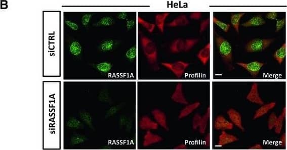 Immunoprecipitation: Profilin 1 Antibody (OTI1D5) [NBP2-02577] - RASSF1A is involved in actin & profilin nuclear export processHeLa cells treated with control or RASSF1A siRNA were fractionated into cytoplasmic & nuclear extracts. Lysates from each fraction were probed for actin & profilin alongside GAPDH (as a marker of the cytoplasmic fraction) & Lamin A/C (as a marker of the nuclear fraction). Right: quantification of nuclear actin & profilin relative to Lamin A/C is shown. Error bars derive from two independent experiments & represent the SEM.Immunofluorescence images of profilin in control & RASSF1A siRNA‐transfected HeLa cells. Right: the profilin localisation was scored as nuclear/cytoplasmic or predominantly cytoplasmic in approximately 100 cells. Error bars derive from three independent experiments & represent the SEM.Confocal images of endogenous monomeric globular actin (G‐actin) in siCTRL & siRASSF1A cells using DNase I staining (Alexa Fluor 488‐conjugated, green). Scale bars = 10 μm.Western blot analysis of actin, profilin, GAPDH & Lamin A/C levels in nuclear & cytoplasmic fractions of MDA‐MB‐231 cells treated with control pcDNA3 or RASSF1A vector. The graph shows the nuclear levels of actin & profilin relative to Lamin A/C in MDA‐MB‐231 cells expressing RASSF1A. Error bars derive from two independent experiments & represent the SEM.Data information: Two‐tailed Student's t‐test was used for statistical analysis. *P < 0.05, **P < 0.01.Source data are available online for this figure. Image collected & cropped by CiteAb from the following publication (//pubmed.ncbi.nlm.nih.gov/31414556), licensed under a CC-BY license. Not internally tested by Novus Biologicals.