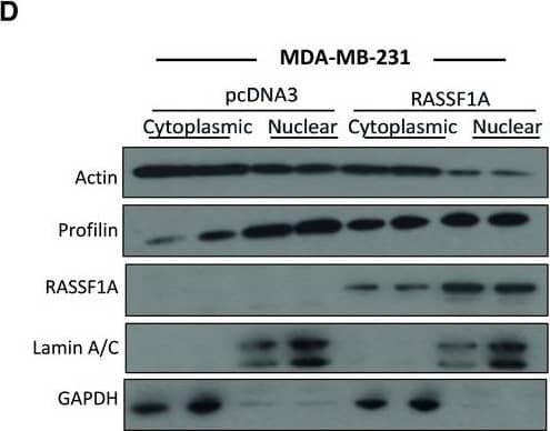 Immunoprecipitation: Profilin 1 Antibody (OTI1D5) [NBP2-02577] - RASSF1A is involved in actin & profilin nuclear export processHeLa cells treated with control or RASSF1A siRNA were fractionated into cytoplasmic & nuclear extracts. Lysates from each fraction were probed for actin & profilin alongside GAPDH (as a marker of the cytoplasmic fraction) & Lamin A/C (as a marker of the nuclear fraction). Right: quantification of nuclear actin & profilin relative to Lamin A/C is shown. Error bars derive from two independent experiments & represent the SEM.Immunofluorescence images of profilin in control & RASSF1A siRNA‐transfected HeLa cells. Right: the profilin localisation was scored as nuclear/cytoplasmic or predominantly cytoplasmic in approximately 100 cells. Error bars derive from three independent experiments & represent the SEM.Confocal images of endogenous monomeric globular actin (G‐actin) in siCTRL & siRASSF1A cells using DNase I staining (Alexa Fluor 488‐conjugated, green). Scale bars = 10 μm.Western blot analysis of actin, profilin, GAPDH & Lamin A/C levels in nuclear & cytoplasmic fractions of MDA‐MB‐231 cells treated with control pcDNA3 or RASSF1A vector. The graph shows the nuclear levels of actin & profilin relative to Lamin A/C in MDA‐MB‐231 cells expressing RASSF1A. Error bars derive from two independent experiments & represent the SEM.Data information: Two‐tailed Student's t‐test was used for statistical analysis. *P < 0.05, **P < 0.01.Source data are available online for this figure. Image collected & cropped by CiteAb from the following publication (//pubmed.ncbi.nlm.nih.gov/31414556), licensed under a CC-BY license. Not internally tested by Novus Biologicals.