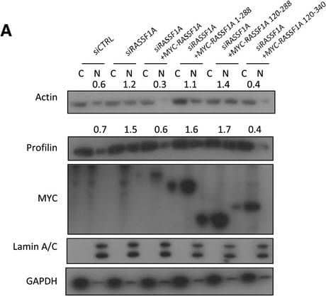 Immunoprecipitation: Profilin 1 Antibody (OTI1D5) [NBP2-02577] - RASSF1A depletion does not affect nuclear F‐actin levelsWestern blot analysis of actin & profilin levels in nuclear & cytoplasmic fractions of cells transfected with truncated RASSF1A mutants.Western blot analysis of actin & profilin levels in nuclear & cytoplasmic fractions of cells transfected with siRASSF1A & siRASSF1A together with XPO6 plasmid.Western blot analysis of actin & profilin levels in nuclear & cytoplasmic fractions of cells transfected with siRNA‐resistant FLAG‐RASSF1A plasmid.Western blot analysis of actin & profilin levels in nuclear & cytoplasmic fractions of cells transfected with siMST2. Quantification of nuclear actin & profilin relative to Lamin A/C is shown. Error bars derive from three independent experiments & represent the SEM.Western blot analysis of exportin‐6 (XPO6) & importin‐9 (IPO9) in the absence of RASSF1A. GAPDH was used as a loading control.Confocal images of endogenous filamentous actin (F‐actin) in siCTRL & siRASSF1A cells using phalloidin staining (Alexa Fluor 568‐conjugated, red). DNA was stained with DAPI. Scale bars = 10 μm.Western blot analysis of actin, profilin, GAPDH & Lamin A/C levels in nuclear & cytoplasmic fractions of MDA‐MB‐231 cells treated with DMSO or 5′‐aza‐dC. The graph shows the nuclear levels of actin & profilin relative to Lamin A/C in MDA‐MB‐231 cells expressing RASSF1A. Error bars derive from two independent experiments & represent the SEM.Data information: Two‐tailed Student's t‐test was used for statistical analysis.*P < 0.05, **P < 0.01, ***P < 0.001.Source data are available online for this figure. Image collected & cropped by CiteAb from the following publication (//pubmed.ncbi.nlm.nih.gov/31414556), licensed under a CC-BY license. Not internally tested by Novus Biologicals.