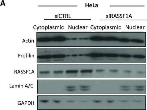 Immunoprecipitation: Profilin 1 Antibody (OTI1D5) [NBP2-02577] - RASSF1A is involved in actin & profilin nuclear export processHeLa cells treated with control or RASSF1A siRNA were fractionated into cytoplasmic & nuclear extracts. Lysates from each fraction were probed for actin & profilin alongside GAPDH (as a marker of the cytoplasmic fraction) & Lamin A/C (as a marker of the nuclear fraction). Right: quantification of nuclear actin & profilin relative to Lamin A/C is shown. Error bars derive from two independent experiments & represent the SEM.Immunofluorescence images of profilin in control & RASSF1A siRNA‐transfected HeLa cells. Right: the profilin localisation was scored as nuclear/cytoplasmic or predominantly cytoplasmic in approximately 100 cells. Error bars derive from three independent experiments & represent the SEM.Confocal images of endogenous monomeric globular actin (G‐actin) in siCTRL & siRASSF1A cells using DNase I staining (Alexa Fluor 488‐conjugated, green). Scale bars = 10 μm.Western blot analysis of actin, profilin, GAPDH & Lamin A/C levels in nuclear & cytoplasmic fractions of MDA‐MB‐231 cells treated with control pcDNA3 or RASSF1A vector. The graph shows the nuclear levels of actin & profilin relative to Lamin A/C in MDA‐MB‐231 cells expressing RASSF1A. Error bars derive from two independent experiments & represent the SEM.Data information: Two‐tailed Student's t‐test was used for statistical analysis. *P < 0.05, **P < 0.01.Source data are available online for this figure. Image collected & cropped by CiteAb from the following publication (//pubmed.ncbi.nlm.nih.gov/31414556), licensed under a CC-BY license. Not internally tested by Novus Biologicals.