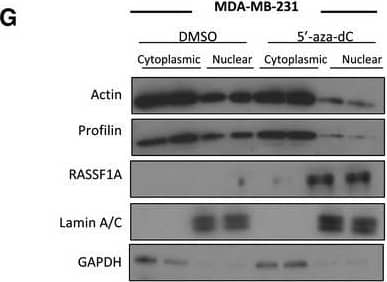 Immunoprecipitation: Profilin 1 Antibody (OTI1D5) [NBP2-02577] - RASSF1A depletion does not affect nuclear F‐actin levelsWestern blot analysis of actin & profilin levels in nuclear & cytoplasmic fractions of cells transfected with truncated RASSF1A mutants.Western blot analysis of actin & profilin levels in nuclear & cytoplasmic fractions of cells transfected with siRASSF1A & siRASSF1A together with XPO6 plasmid.Western blot analysis of actin & profilin levels in nuclear & cytoplasmic fractions of cells transfected with siRNA‐resistant FLAG‐RASSF1A plasmid.Western blot analysis of actin & profilin levels in nuclear & cytoplasmic fractions of cells transfected with siMST2. Quantification of nuclear actin & profilin relative to Lamin A/C is shown. Error bars derive from three independent experiments & represent the SEM.Western blot analysis of exportin‐6 (XPO6) & importin‐9 (IPO9) in the absence of RASSF1A. GAPDH was used as a loading control.Confocal images of endogenous filamentous actin (F‐actin) in siCTRL & siRASSF1A cells using phalloidin staining (Alexa Fluor 568‐conjugated, red). DNA was stained with DAPI. Scale bars = 10 μm.Western blot analysis of actin, profilin, GAPDH & Lamin A/C levels in nuclear & cytoplasmic fractions of MDA‐MB‐231 cells treated with DMSO or 5′‐aza‐dC. The graph shows the nuclear levels of actin & profilin relative to Lamin A/C in MDA‐MB‐231 cells expressing RASSF1A. Error bars derive from two independent experiments & represent the SEM.Data information: Two‐tailed Student's t‐test was used for statistical analysis.*P < 0.05, **P < 0.01, ***P < 0.001.Source data are available online for this figure. Image collected & cropped by CiteAb from the following publication (//pubmed.ncbi.nlm.nih.gov/31414556), licensed under a CC-BY license. Not internally tested by Novus Biologicals.