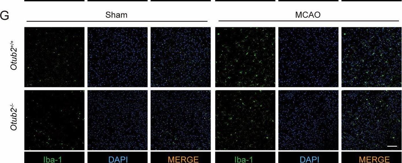 OTUB2 deficiency diminishes MCAO-induced neuronal loss and neuroinflammation.(A) Representative immunofluorescence staining of OTUB2 (red) and NeuN (green) in the brain of C57BL/6 mice. Scale bar, 20 μm. (B) On day 2 after MCAO, the ischemic cerebral hemisphere of Otub2+/+ and Otub2−/− mice was analyzed by Western blot with indicated antibodies. (C, D) The relative expression of NeuN (C) and PSD95 (D) was quantified after normalization to GAPDH. Unpaired Student’s t test, n = 4/group, biological replicates. (E, F) Representative immunofluorescence staining (E) and quantification (F) of NeuN+ cells in the ischemic penumbra on day 2 after MCAO. Scale bar, 100 μm. Unpaired Student’s t test, n = 5/group, biological replicates. (G) Representative immunofluorescence staining of Iba1+ cells in the ischemic penumbra on day 2 after MCAO. Scale bar, 100 μm. (H) Representative z-stack images of Iba1+ cells in the ischemic penumbra on day 2 after MCAO. Scale bar, 5 μm. (I–M) Forty-eight hours after MCAO, the relative transcription of Il1b (I), Il6 (J), Tnf (K), Ccl2 (L), and Cxcl10 (M) in the ischemic cerebral hemisphere was determined by qRT-PCR. Mann–Whitney U test (I) and Unpaired Student’s t test (J–M), n = 5–7/group, biological replicates. Data in (C, D, I–M) show the mean +/- SEM. Source data are available online for this figure. Image collected and cropped by CiteAb from the following open publication (//pubmed.ncbi.nlm.nih.gov/40021931), licensed under a CC-BY license. Not internally tested by Novus Biologicals.