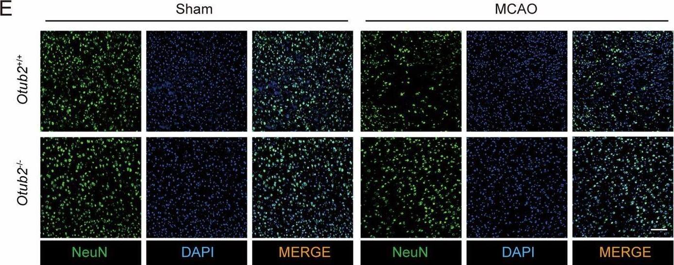 OTUB2 deficiency diminishes MCAO-induced neuronal loss and neuroinflammation.(A) Representative immunofluorescence staining of OTUB2 (red) and NeuN (green) in the brain of C57BL/6 mice. Scale bar, 20 μm. (B) On day 2 after MCAO, the ischemic cerebral hemisphere of Otub2+/+ and Otub2−/− mice was analyzed by Western blot with indicated antibodies. (C, D) The relative expression of NeuN (C) and PSD95 (D) was quantified after normalization to GAPDH. Unpaired Student’s t test, n = 4/group, biological replicates. (E, F) Representative immunofluorescence staining (E) and quantification (F) of NeuN+ cells in the ischemic penumbra on day 2 after MCAO. Scale bar, 100 μm. Unpaired Student’s t test, n = 5/group, biological replicates. (G) Representative immunofluorescence staining of Iba1+ cells in the ischemic penumbra on day 2 after MCAO. Scale bar, 100 μm. (H) Representative z-stack images of Iba1+ cells in the ischemic penumbra on day 2 after MCAO. Scale bar, 5 μm. (I–M) Forty-eight hours after MCAO, the relative transcription of Il1b (I), Il6 (J), Tnf (K), Ccl2 (L), and Cxcl10 (M) in the ischemic cerebral hemisphere was determined by qRT-PCR. Mann–Whitney U test (I) and Unpaired Student’s t test (J–M), n = 5–7/group, biological replicates. Data in (C, D, I–M) show the mean +/- SEM. Source data are available online for this figure. Image collected and cropped by CiteAb from the following open publication (//pubmed.ncbi.nlm.nih.gov/40021931), licensed under a CC-BY license. Not internally tested by Novus Biologicals.