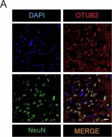 OTUB2 deficiency diminishes MCAO-induced neuronal loss and neuroinflammation.(A) Representative immunofluorescence staining of OTUB2 (red) and NeuN (green) in the brain of C57BL/6 mice. Scale bar, 20 μm. (B) On day 2 after MCAO, the ischemic cerebral hemisphere of Otub2+/+ and Otub2−/− mice was analyzed by Western blot with indicated antibodies. (C, D) The relative expression of NeuN (C) and PSD95 (D) was quantified after normalization to GAPDH. Unpaired Student’s t test, n = 4/group, biological replicates. (E, F) Representative immunofluorescence staining (E) and quantification (F) of NeuN+ cells in the ischemic penumbra on day 2 after MCAO. Scale bar, 100 μm. Unpaired Student’s t test, n = 5/group, biological replicates. (G) Representative immunofluorescence staining of Iba1+ cells in the ischemic penumbra on day 2 after MCAO. Scale bar, 100 μm. (H) Representative z-stack images of Iba1+ cells in the ischemic penumbra on day 2 after MCAO. Scale bar, 5 μm. (I–M) Forty-eight hours after MCAO, the relative transcription of Il1b (I), Il6 (J), Tnf (K), Ccl2 (L), and Cxcl10 (M) in the ischemic cerebral hemisphere was determined by qRT-PCR. Mann–Whitney U test (I) and Unpaired Student’s t test (J–M), n = 5–7/group, biological replicates. Data in (C, D, I–M) show the mean +/- SEM. Source data are available online for this figure. Image collected and cropped by CiteAb from the following open publication (//pubmed.ncbi.nlm.nih.gov/40021931), licensed under a CC-BY license. Not internally tested by Novus Biologicals.