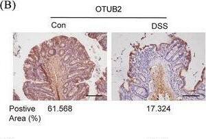 Colonic expression OTUB2 is downregulated in colitis. (A) Representative immunohistochemical staining of OTUB2 in control and UC colon samples. Scale bar = 50 um. (B) Representative immunohistochemical staining of OTUB2 in colon samples from control and DSS‐treated C57BL/6 mice. Control mice received regular drinking water. Mice in the DSS group were given 2% DSS for 8 days, followed by regular drinking water for 2 days. Scale bar = 50 um. (C, D) Representative immunoblots (C) and relative quantification (D) of OTUB2 protein in colon samples from control and DSS‐treated C57BL/6 mice. (E) Relative mRNA levels of Otub2 in colon samples from control and DSS‐treated C57BL/6 mice were analysed by qRT‐PCR. (F) Western blot analysis of OTUB2 protein abundance in colon samples from Otub2+/+ and Otub2–/– mice. (G) The representative image (left) and length (right) of colons from Otub2+/+ and Otub2–/– mice. (H, I) Representative H&E (H) and PAS/AB (I) staining of colons from Otub2+/+ and Otub2–/– mice. Scale bar = 50 um. Data in D, E and G are shown as mean +/- SEM. ns, no significant difference. *p < .05, **p < .01. Image collected and cropped by CiteAb from the following open publication (//pubmed.ncbi.nlm.nih.gov/39358938), licensed under a CC-BY license. Not internally tested by Novus Biologicals.