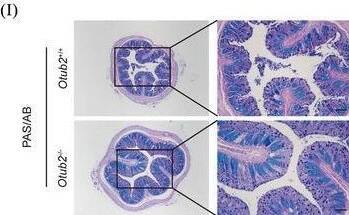 Colonic expression OTUB2 is downregulated in colitis. (A) Representative immunohistochemical staining of OTUB2 in control and UC colon samples. Scale bar = 50 um. (B) Representative immunohistochemical staining of OTUB2 in colon samples from control and DSS‐treated C57BL/6 mice. Control mice received regular drinking water. Mice in the DSS group were given 2% DSS for 8 days, followed by regular drinking water for 2 days. Scale bar = 50 um. (C, D) Representative immunoblots (C) and relative quantification (D) of OTUB2 protein in colon samples from control and DSS‐treated C57BL/6 mice. (E) Relative mRNA levels of Otub2 in colon samples from control and DSS‐treated C57BL/6 mice were analysed by qRT‐PCR. (F) Western blot analysis of OTUB2 protein abundance in colon samples from Otub2+/+ and Otub2–/– mice. (G) The representative image (left) and length (right) of colons from Otub2+/+ and Otub2–/– mice. (H, I) Representative H&E (H) and PAS/AB (I) staining of colons from Otub2+/+ and Otub2–/– mice. Scale bar = 50 um. Data in D, E and G are shown as mean +/- SEM. ns, no significant difference. *p < .05, **p < .01. Image collected and cropped by CiteAb from the following open publication (//pubmed.ncbi.nlm.nih.gov/39358938), licensed under a CC-BY license. Not internally tested by Novus Biologicals.